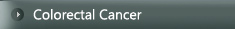 Colorectal Cancer - Mr Jim S Khan - Consultant Laparoscopic, Colorectal  General Surgeon