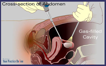 Cross-section of Abdomen